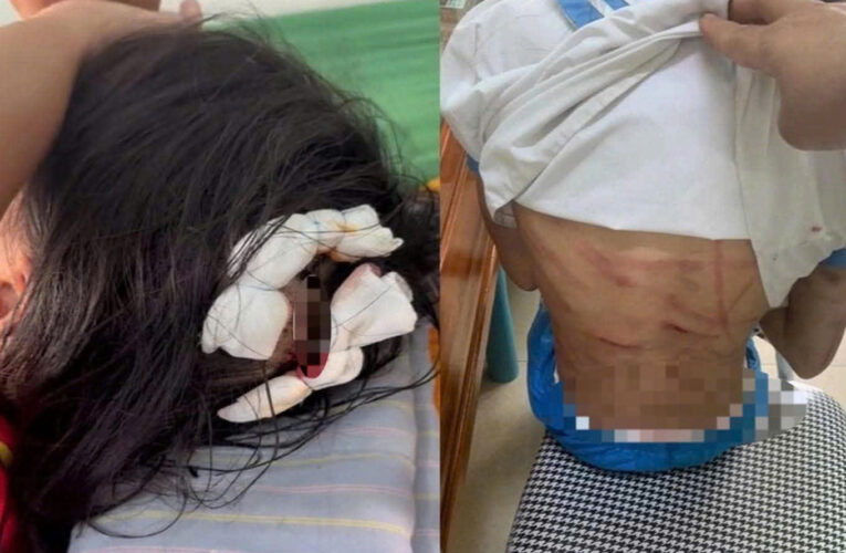 Khi Ánh Sáng Tuổi Thơ Phải Gồng Mình Chịu Đớn Đau