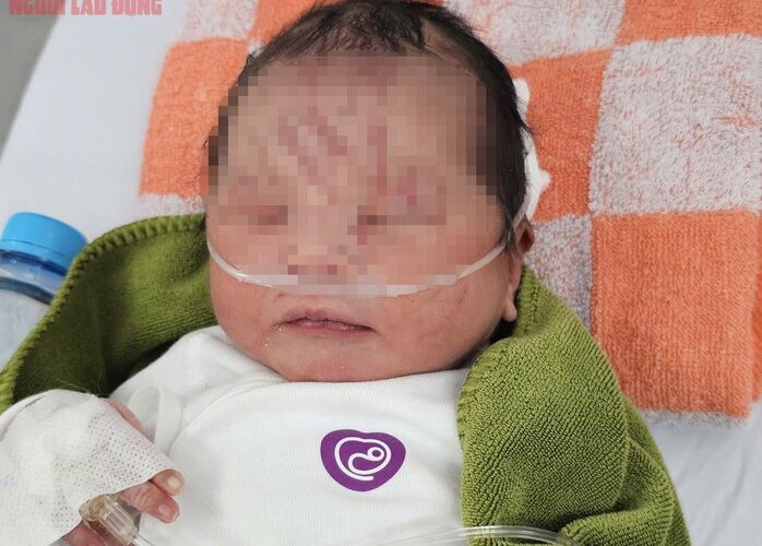 NÓNG: Một trẻ sơ sinh nghi bị “chôn sống” tại vườn cao su